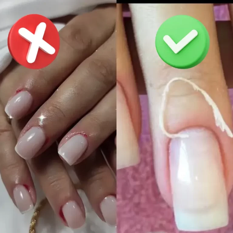 Remoção de cutículas
